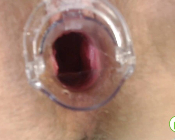 PregnantMiodelka - Painful gyno exam Gaping hairy pussy wi, Doctor, Fetish, Gyno, Med Exam, Med Gyno, ManyVids