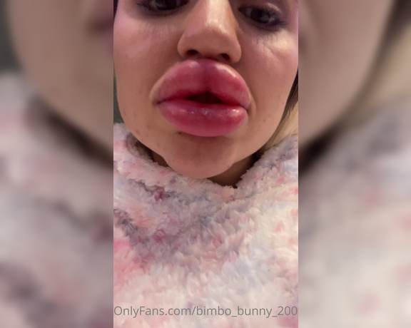 Jessy Bunny aka jessy.bunny.official - 12-14-2021 OnlyFans Video - Just got my lips and chin enhanced  sorry for being so offline the last days,