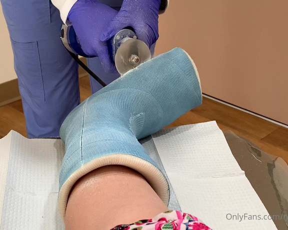Nickeyhuntsman - Videos between seconds to min each of my foot cast being sawed off, unwrapped, and 9 (11.01.2021)